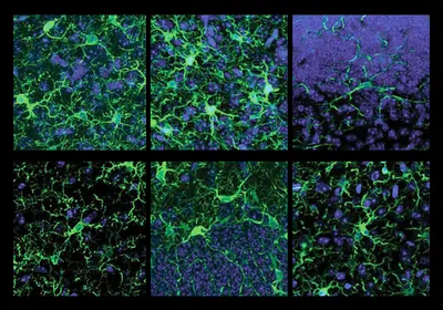 Panels showing different kinds of microglia